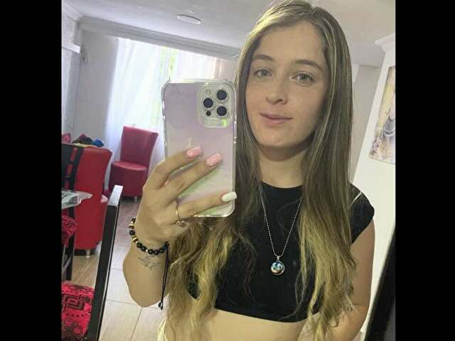 anacute foto 3