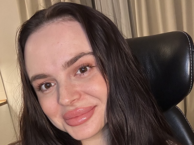 AuroraGaze preview 1